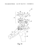 TRIALING SYSTEM FOR A KNEE PROSTHESIS AND METHOD OF USE diagram and image