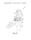 TRIALING SYSTEM FOR A KNEE PROSTHESIS AND METHOD OF USE diagram and image