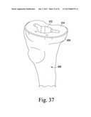 TRIALING SYSTEM FOR A KNEE PROSTHESIS AND METHOD OF USE diagram and image