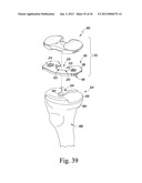 TRIALING SYSTEM FOR A KNEE PROSTHESIS AND METHOD OF USE diagram and image