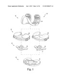 SYSTEM AND METHOD OF TRIALING A KNEE PROSTHESIS diagram and image