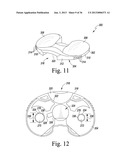 SYSTEM AND METHOD OF TRIALING A KNEE PROSTHESIS diagram and image