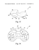 SYSTEM AND METHOD OF TRIALING A KNEE PROSTHESIS diagram and image