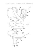 SYSTEM AND METHOD OF TRIALING A KNEE PROSTHESIS diagram and image