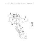 SYSTEM AND METHOD OF TRIALING A KNEE PROSTHESIS diagram and image