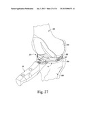 SYSTEM AND METHOD OF TRIALING A KNEE PROSTHESIS diagram and image