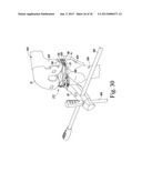 SYSTEM AND METHOD OF TRIALING A KNEE PROSTHESIS diagram and image