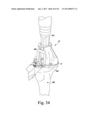 SYSTEM AND METHOD OF TRIALING A KNEE PROSTHESIS diagram and image