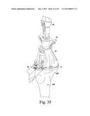 SYSTEM AND METHOD OF TRIALING A KNEE PROSTHESIS diagram and image