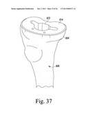 SYSTEM AND METHOD OF TRIALING A KNEE PROSTHESIS diagram and image