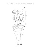 SYSTEM AND METHOD OF TRIALING A KNEE PROSTHESIS diagram and image