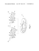 METHOD OF USING A TRIALING SYSTEM FOR A KNEE PROSTHESIS diagram and image