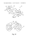 METHOD OF USING A TRIALING SYSTEM FOR A KNEE PROSTHESIS diagram and image