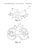 METHOD OF USING A TRIALING SYSTEM FOR A KNEE PROSTHESIS diagram and image