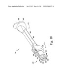 METHOD OF USING A TRIALING SYSTEM FOR A KNEE PROSTHESIS diagram and image