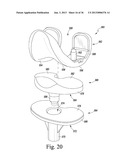 METHOD OF USING A TRIALING SYSTEM FOR A KNEE PROSTHESIS diagram and image