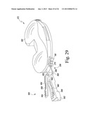 METHOD OF USING A TRIALING SYSTEM FOR A KNEE PROSTHESIS diagram and image