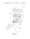 METHOD OF USING A TRIALING SYSTEM FOR A KNEE PROSTHESIS diagram and image