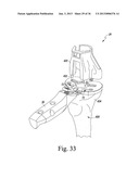 METHOD OF USING A TRIALING SYSTEM FOR A KNEE PROSTHESIS diagram and image