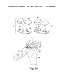 METHOD OF USING A TRIALING SYSTEM FOR A KNEE PROSTHESIS diagram and image