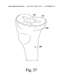 METHOD OF USING A TRIALING SYSTEM FOR A KNEE PROSTHESIS diagram and image