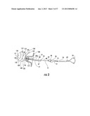 PYLORIC VALVE DEVICES AND METHODS diagram and image