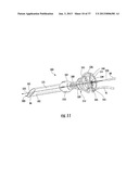 PYLORIC VALVE DEVICES AND METHODS diagram and image