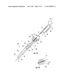 PYLORIC VALVE DEVICES AND METHODS diagram and image