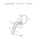 PYLORIC VALVE DEVICES AND METHODS diagram and image