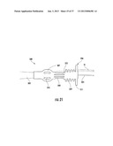 PYLORIC VALVE DEVICES AND METHODS diagram and image