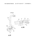 PYLORIC VALVE DEVICES AND METHODS diagram and image