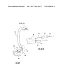 PYLORIC VALVE DEVICES AND METHODS diagram and image