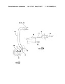 PYLORIC VALVE DEVICES AND METHODS diagram and image