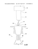 PYLORIC VALVE DEVICES AND METHODS diagram and image