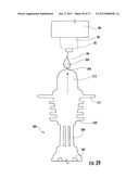 PYLORIC VALVE DEVICES AND METHODS diagram and image