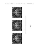 Method for Detecting Foreign Object Damage in Turbomachinery diagram and image