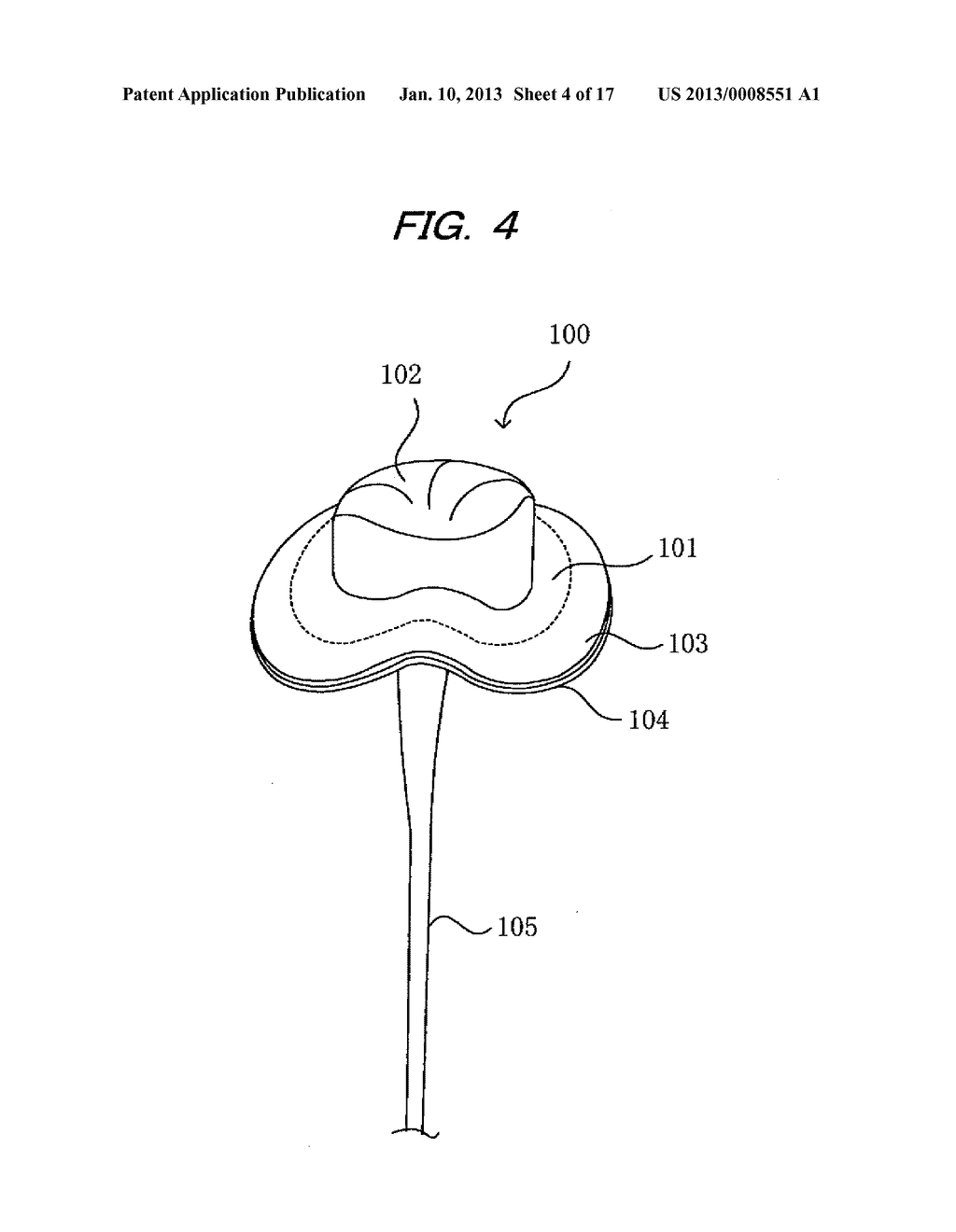 LATERAL PIPE LINING MATERIAL, METHOD FOR PRODUCTION OF SAME, AND LATERAL     PIPE LINING PROCESS - diagram, schematic, and image 05