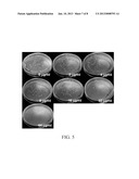 METHOD FOR ANTIBIOTIC SUSCEPTIBILITY TESTING AND DETERMINING MINIMUM     INHIBITORY CONCENTRATION OF THE ANTIBIOTIC diagram and image