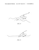 TOWABLE AIR VEHICLE diagram and image