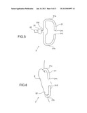 AURICLE-INSTALLED APPARATUS diagram and image