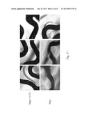 Uniform Field Magnetization and Targeting of Therapeutic Formulations diagram and image