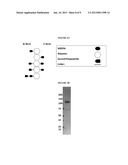 Serpin Fusion Polypeptides and Methods of Use Thereof diagram and image