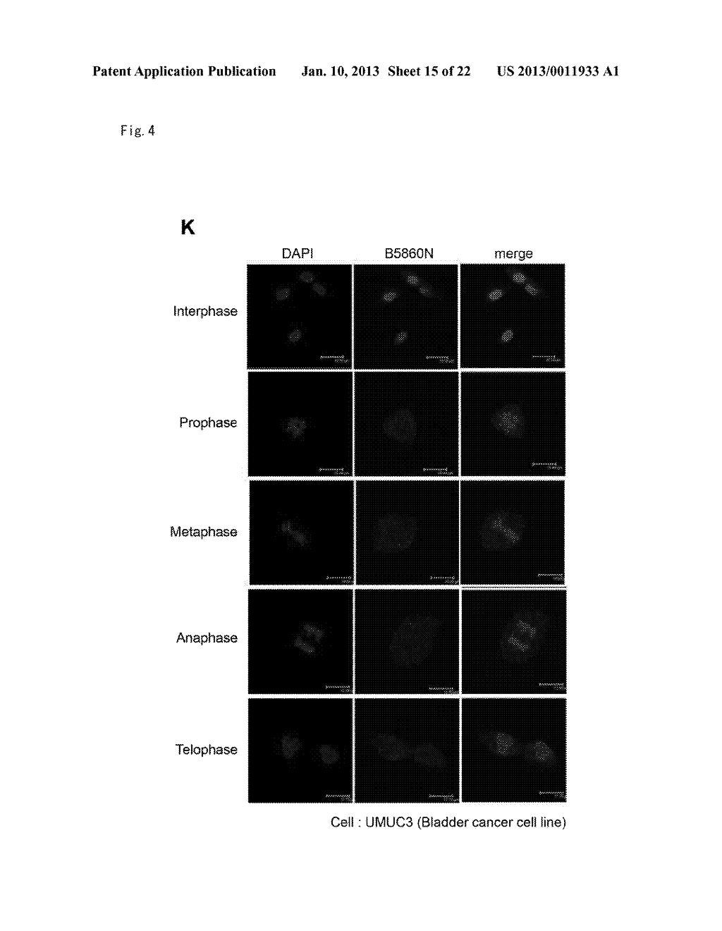 METHOD OF DIAGNOSING BLADDER CANCER - diagram, schematic, and image 16