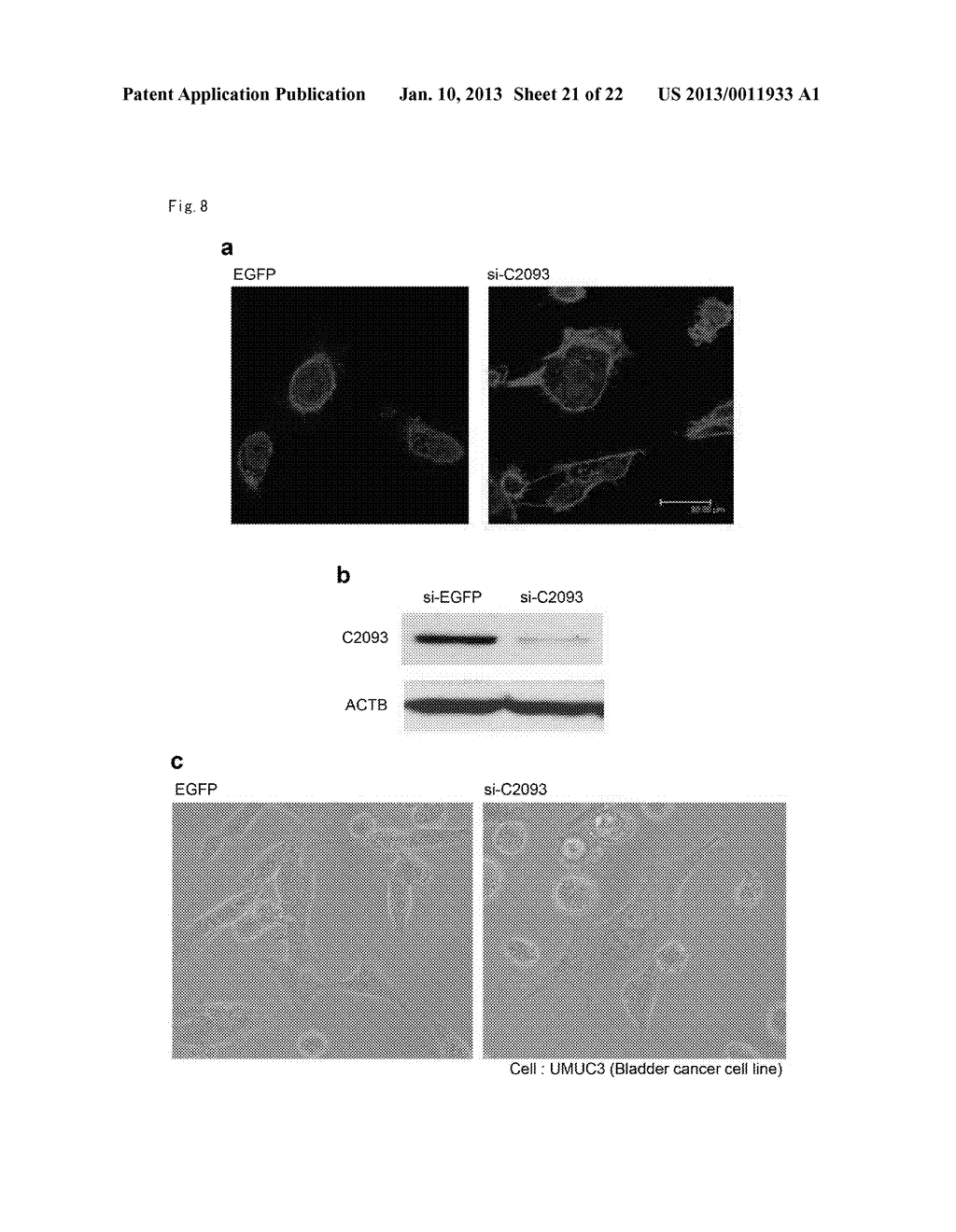 METHOD OF DIAGNOSING BLADDER CANCER - diagram, schematic, and image 22