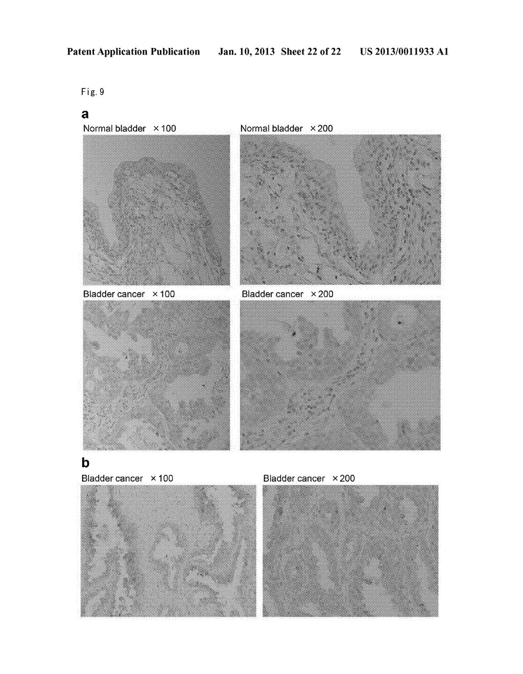 METHOD OF DIAGNOSING BLADDER CANCER - diagram, schematic, and image 23