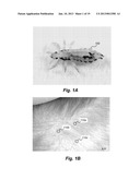 TREATMENT OF HEAD LICE INFESTATIONS diagram and image