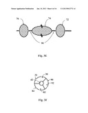 RESECTOR BALLOON SYSTEM diagram and image