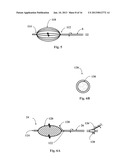 RESECTOR BALLOON SYSTEM diagram and image