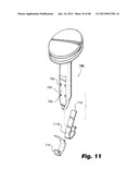 Low-profile surgical access devices with anchoring diagram and image