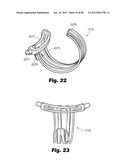 Low-profile surgical access devices with anchoring diagram and image